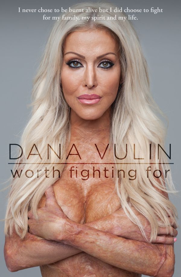Cover Art for 9780143797319, Worth Fighting For by Dana Vulin
