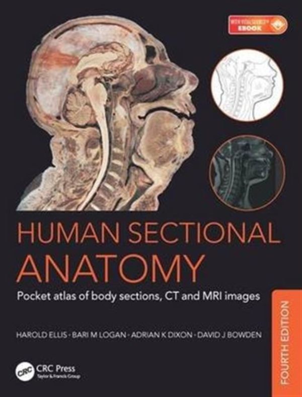 Cover Art for 9781498708548, Human Sectional AnatomyPocket Atlas of Body Sections, CT and MRI Images by Harold Ellis, Adrian Kendal Dixon, Bari M. Logan, David J. Bowden