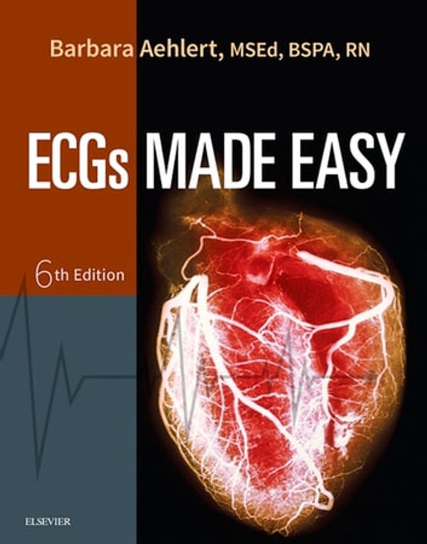 Cover Art for 9780323415477, ECGs Made Easy by Barbara J. Aehlert