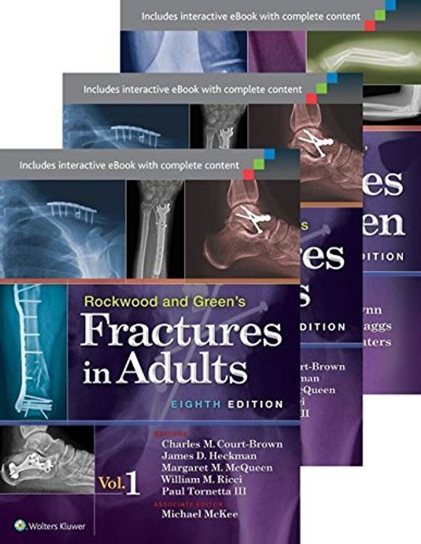 Cover Art for B019NS0PJA, Rockwood, Green, and Wilkins' Fractures in Adults and Children Package by Paul Tornetta III MD (2014-09-23) by Paul Tornetta MD; MD; James D. Heckman MD; Michael McKee FRCS (C); Margaret M. McQueen MD; William Ricci MD; John M. Flynn MD; David L. Skaggs MD; Peter M Charles-Waters, III, MD, MD