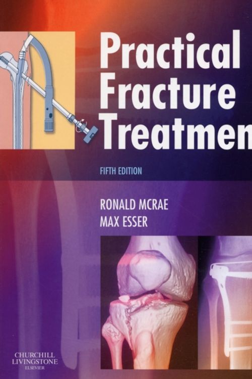 Cover Art for 9780443068768, Practical Fracture Treatment by Ronald McRae, Max Esser