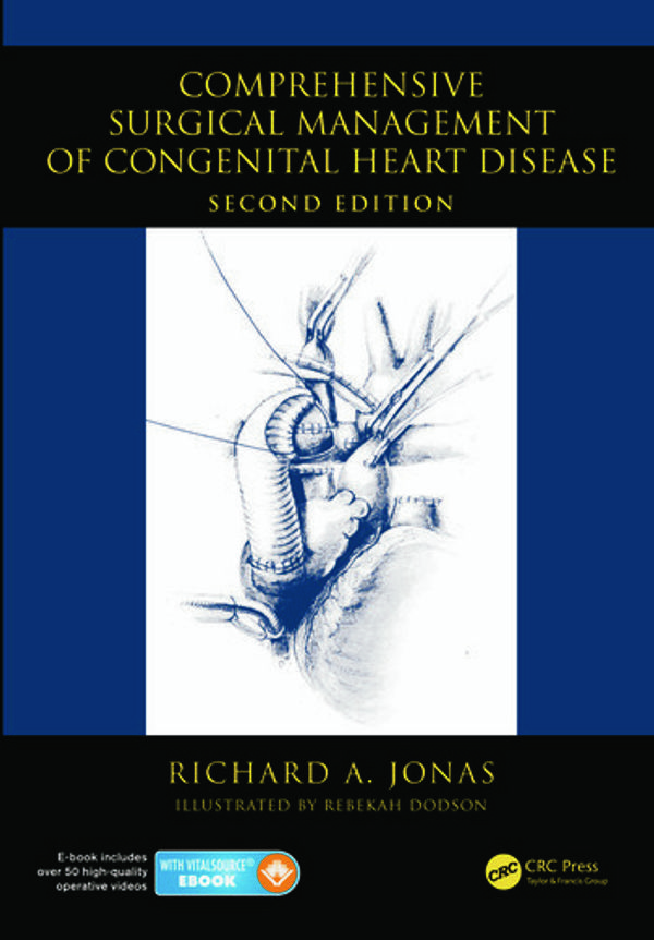 Cover Art for 9781444112153, Comprehensive Surgical Management of Congenital Heart Disease, Second Edition by Richard A. Jonas