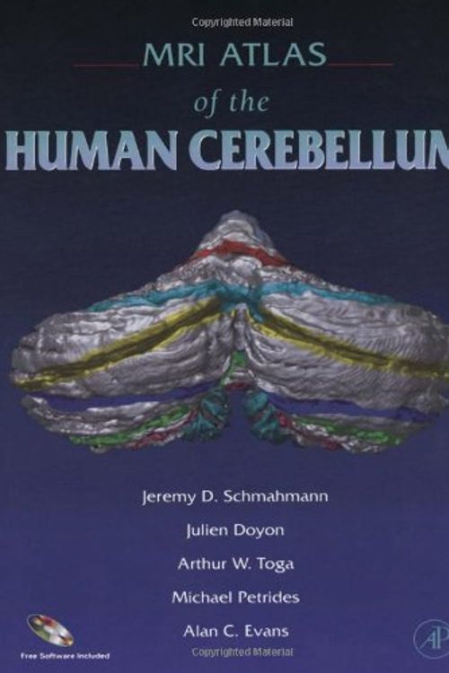 Cover Art for 9780126256659, MRI Atlas of the Human Cerebellum by Jeremy D. Schmahmann