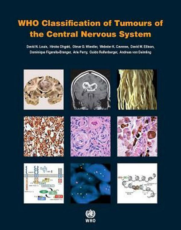 Cover Art for 9789283244929, Who Classification of Tumours of the Central Nervous System (IARC Who Classification of Tumours) by International Agency for Research on Cancer
