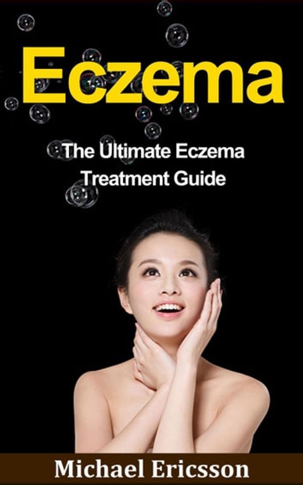 Cover Art for 9781507057254, Eczema: The Ultimate Eczema Treatment Guide by Dr. Michael Ericsson