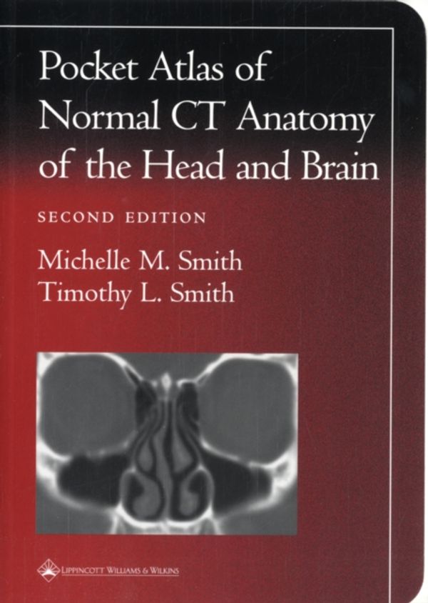 Cover Art for 9780781729499, A Pocket Atlas of Normal CT Anatomy of the Head and Brain by Michelle M. Smith