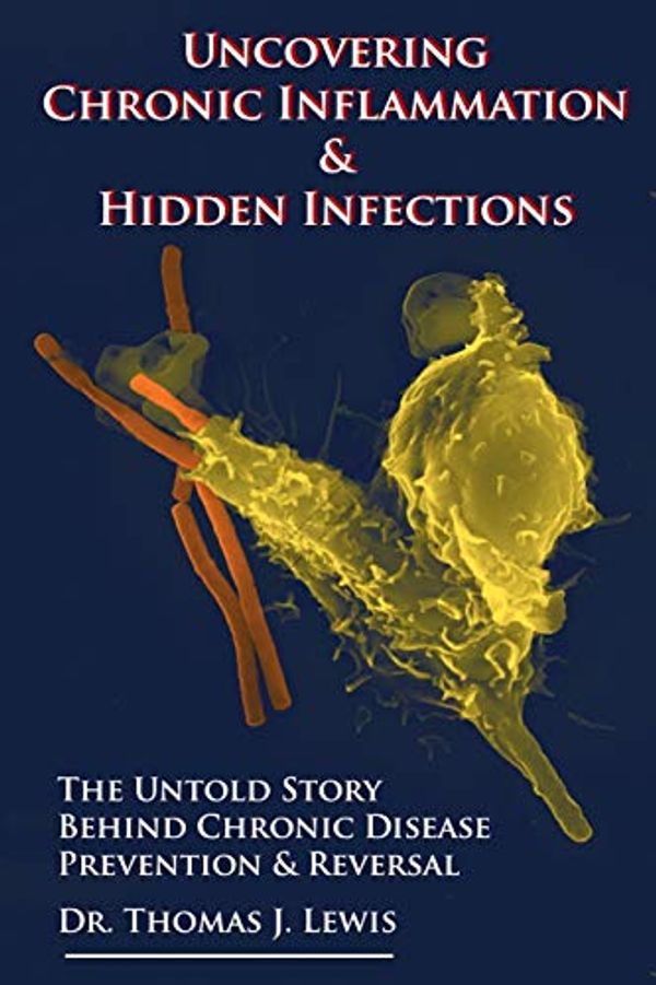 Cover Art for 9781790518753, Uncovering Chronic Inflammation & Hidden Infections by Lewis Phd, Thomas J