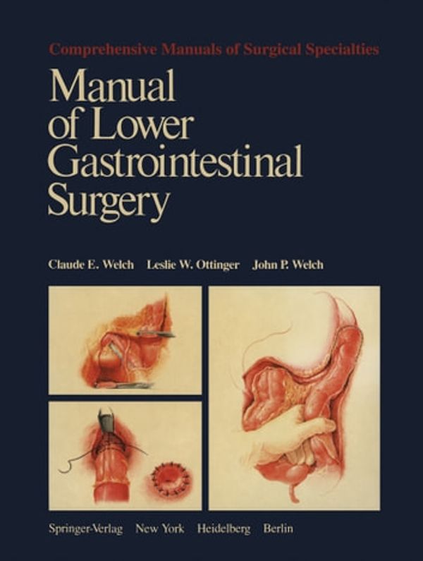 Cover Art for 9781461260127, Manual of Lower Gastrointestinal Surgery by Claude E. Welch, John P. Welch, Leslie W. Ottinger