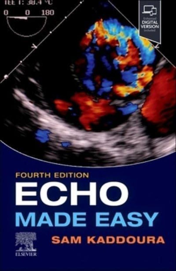 Cover Art for 9780702083600, Echo Made Easy by Sam Kaddoura