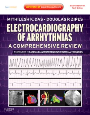Cover Art for 9781437720297, Electrocardiography of Arrhythmias: A Comprehensive Review by Mithilesh Kumar Das, Douglas P. Zipes