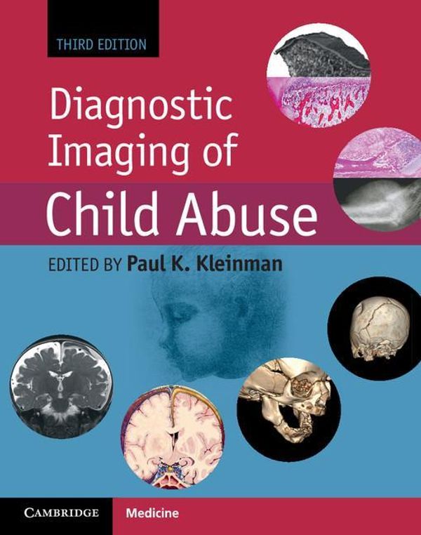 Cover Art for 9781316308325, Diagnostic Imaging of Child Abuse by Kleinman, Paul K.