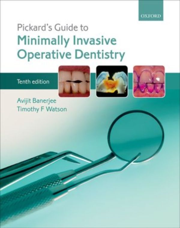 Cover Art for 9780198712091, Pickard's Guide to Minimally Invasive Operative Dentistry by Avijit Banerjee, Timothy F. Watson