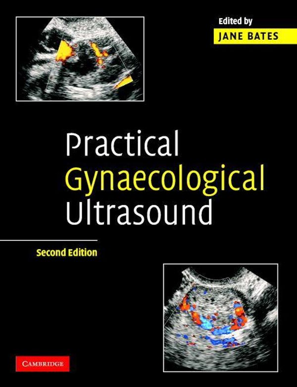 Cover Art for 9780511893933, Practical Gynaecological Ultrasound by 