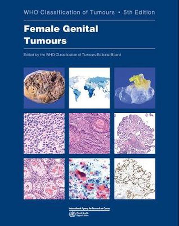 Cover Art for 9789283245049, Female Genital Tumours: WHO Classification of Tumours Volume 4 by International Agency for Research on Cancer, World Health Organization