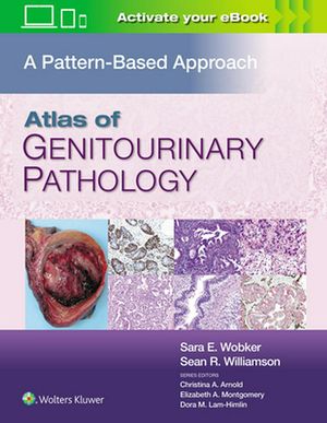 Cover Art for 9781496397669, Atlas of Genitourinary Pathology: A Pattern Based Approach by Wobker Williamson