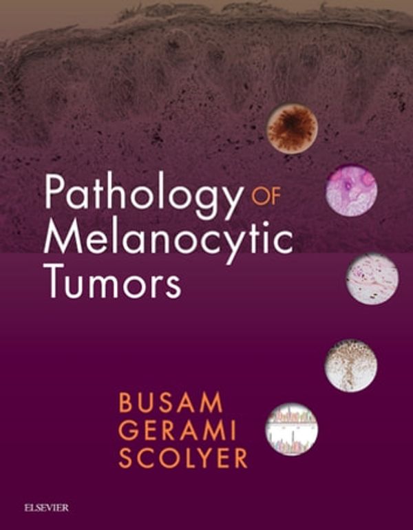 Cover Art for 9780323508681, Pathology of Melanocytic Tumors by Klaus J. Busam, Richard A Scolyer, Pedram Gerami