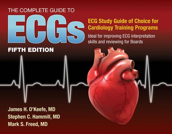 Cover Art for 9781284199055, The Complete Guide to Ecgs: A Comprehensive Study Guide to Improve ECG Interpretation Skills by James H. O'Keefe Jr.