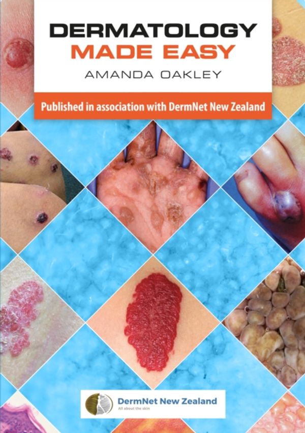 Cover Art for 9781907904820, Dermatology Made Easy by Amanda Oakley