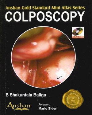 Cover Art for 9781905740093, Mini Atlas of Colposcopy by B. Shakuntala Baliga