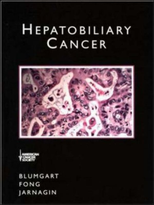 Cover Art for 9781550091328, Hepatobiliary Cancer by Leslie H. Blumgart