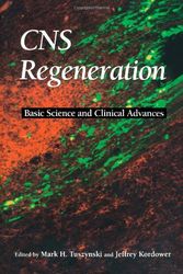 Cover Art for 9780127050706, CNS Regeneration: Basic Science and Clinical Advances by Mark H. Tuszynski