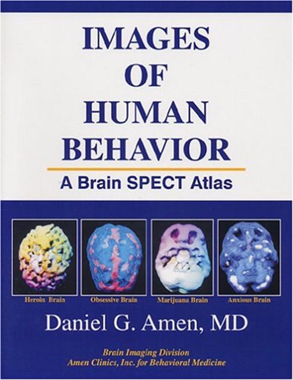 Cover Art for 9781886554047, Images of Human Behavior: A Brain SPECT Atlas by Daniel G. Amen