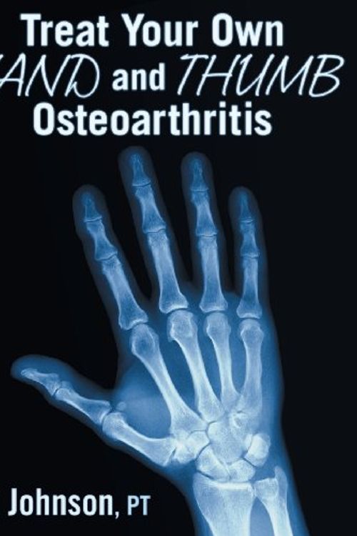 Cover Art for 9781457513831, Treat Your Own Hand and Thumb Osteoarthritis by Pt Jim Johnson