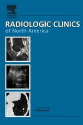 Cover Art for 9781416039013, Upper Extremity, An Issue of Radiologic Clinics, 1e (The Clinics: Radiology) by Javier Beltran MD