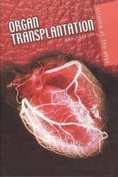 Cover Art for 9780431124919, Organ Transplantation by Ann Fullick