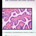 Cover Art for 9780781799935, Biopsy Interpretation of the Central Nervous System by Matthew J. Schniederjan