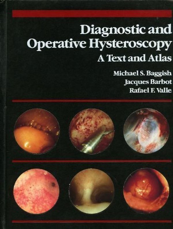 Cover Art for 9780815104605, Diagnostic and Operative Hysteroscopy by Michael S. Baggish