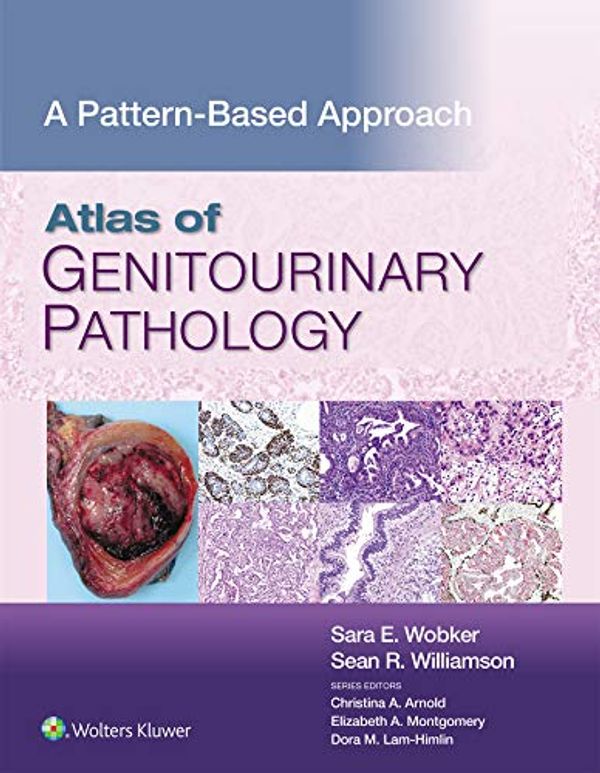 Cover Art for B08L45DC2J, Atlas of Genitourinary Pathology: A Pattern Based Approach by Sara E. Wobker, Sean R. Williamson