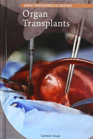 Cover Art for 9781502643797, Organ Transplants by Cathleen Small