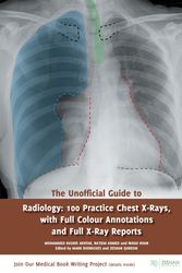Cover Art for 9781910399019, The Unofficial Guide to Radiology: 100 Practice Chest X Rays with Full Colour Annotations and Full X Ray Reports by Na'eem Ahmed MBBS BSc