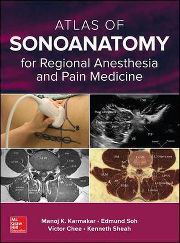 Cover Art for 9780071789349, Atlas of Sonoanatomy for Regional Anesthesia and Pain Medicine by Manoj Karmakar
