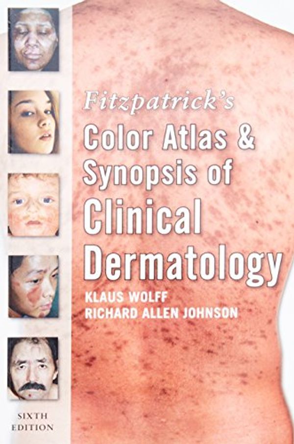 Cover Art for 9780071599757, Fitzpatrick's Color Atlas and Synopsis of Clinical Dermatology by Klaus Wolff