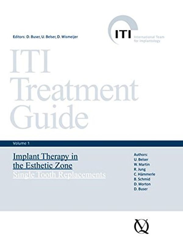 Cover Art for 9783938947104, ITI Treatment Guide: Implant Therapy in the Esthetic Zone - Single-tooth Replacements v. 1 by U. Belser