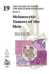 Cover Art for 9781933477428, Melanocytic Tumors of Skin by Kara Taylor