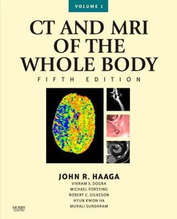 Cover Art for 9780323053754, CT and MRI of the Whole Body, 2-Volume Set by Daniel Boll