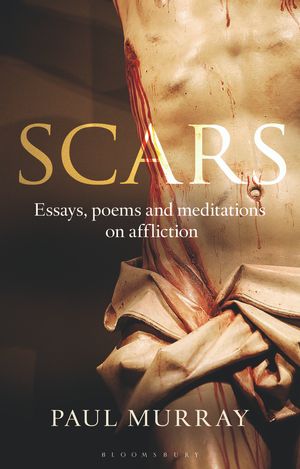 Cover Art for 9781441175632, Scars by Murray OP, Dr Paul