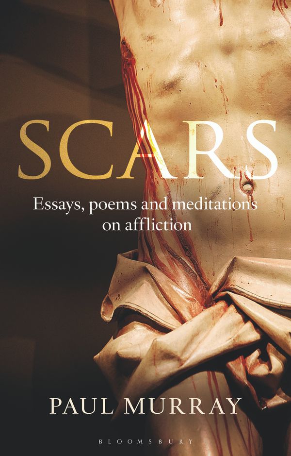 Cover Art for 9781441175632, Scars by Murray OP, Dr Paul