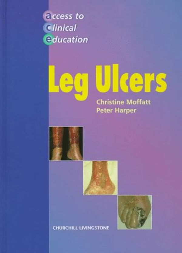 Cover Art for 9780443055331, Leg Ulcers by Christine J. Moffatt