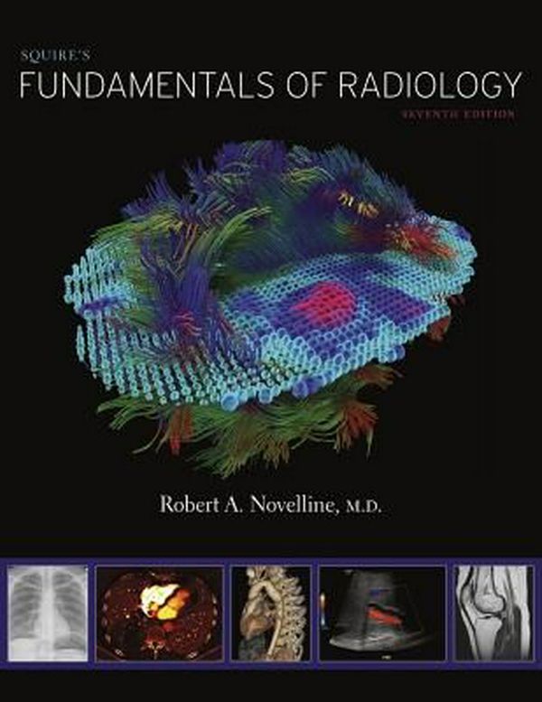 Cover Art for 9780674057951, Squire's Fundamentals of Radiology: Seventh Edition by Robert A. Novelline