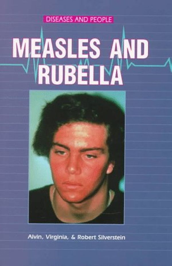 Cover Art for 9780894907142, Measles and Rubella by Virginia B. Silverstein; Robert Silverstein; Alvin Silverstein