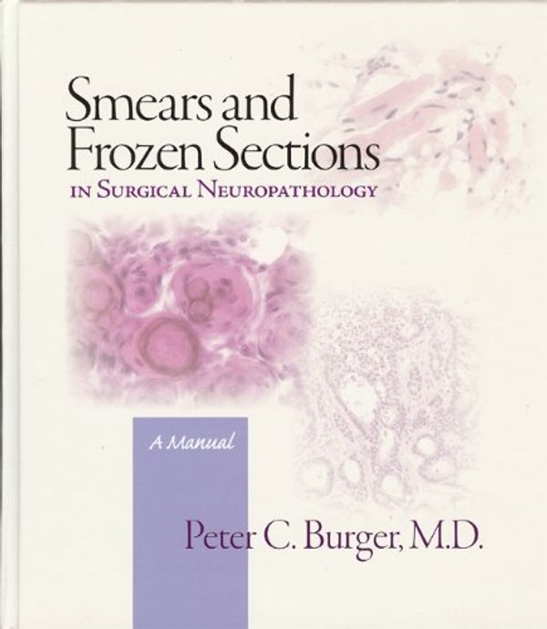Cover Art for 9780692003169, Smears and Frozen Sections in Surgical Neuropathology by Peter Burger