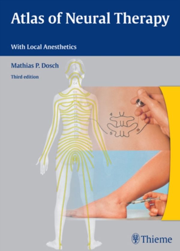 Cover Art for 9783131305732, Altas of Neural Therapy with Local Anesthetics by Mathias Dosch