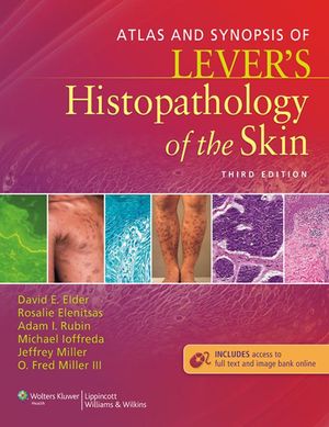 Cover Art for 9781451171631, Atlas and Synopsis of Lever's Histopathology of the Skin by Adam I. Rubin, David E. Elder, Jeffrey Miller, Michael Ioffreda, O. Fred Miller, Rosalie Elenitsas