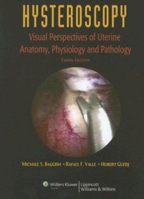 Cover Art for 0000781755328, Hysteroscopy: Visual Perspectives of Uterine Anatomy, Physiology, and Pathology by Michael S. Baggish