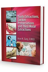 Cover Art for 9780982095386, Tooth Extractions, Socket Preservations and Third Molar Extractions by Arun K. Garg
