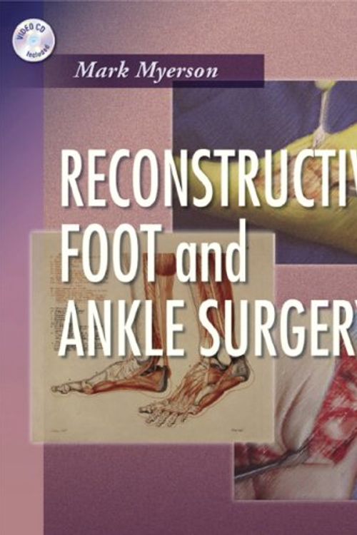 Cover Art for 9781416023586, Reconstructive Foot and Ankle Surgery by Mark S. Myerson
